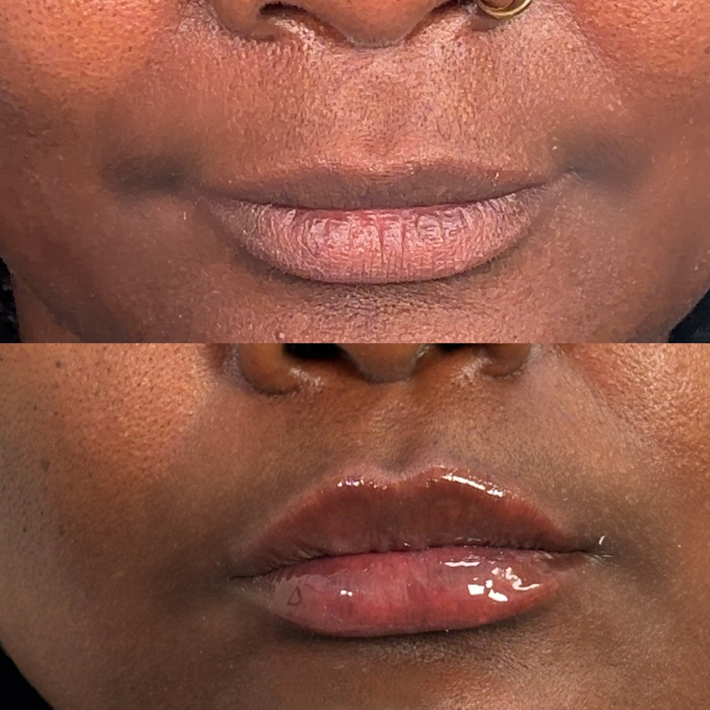 Luxe 2ml Lip Filler Plumping Pen